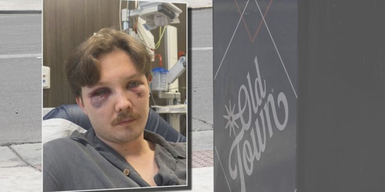 Colorado Groom Assaulted During His Bachelor Party In Old Town Scottsdale