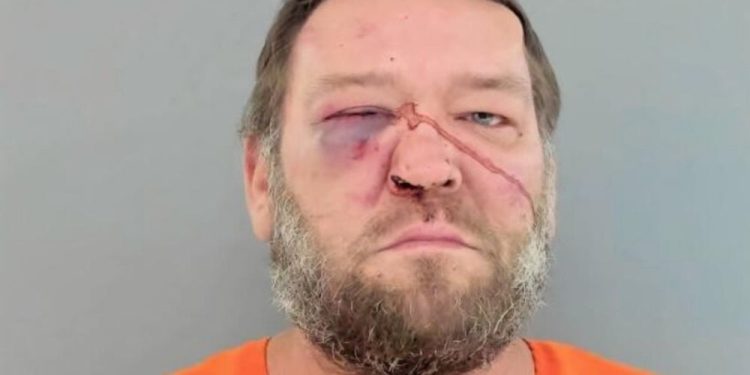 Man Detained After Firing At Deputies