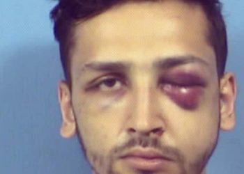 Home Invader Gets Black Eye From Residents, Receives 20-Year Sentence From Judge
