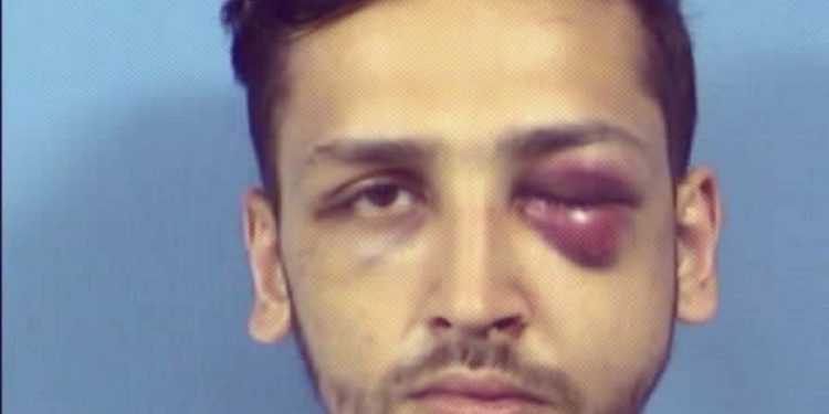 Home Invader Gets Black Eye From Residents, Receives 20-Year Sentence From Judge