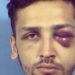 Home Invader Gets Black Eye From Residents, Receives 20-Year Sentence From Judge
