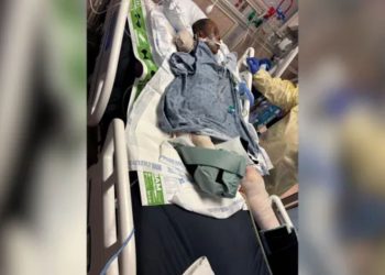 Police: Woman dies after brutal dog attack in Mississippi