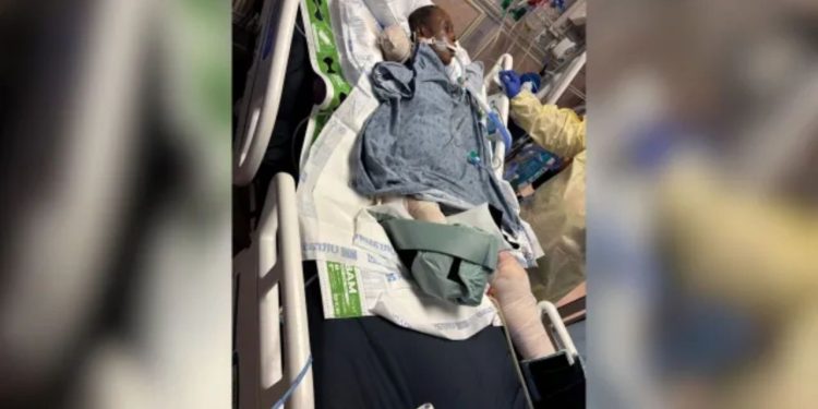 Police: Woman dies after brutal dog attack in Mississippi