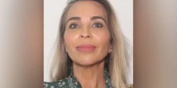 Florida woman accused of stealing hundreds of thousands from HOAs for plastic surgery, lavish trips